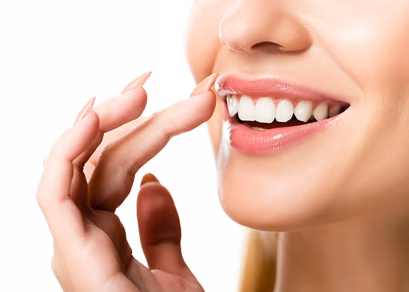 10 Things You Should Know Before You Get Veneers