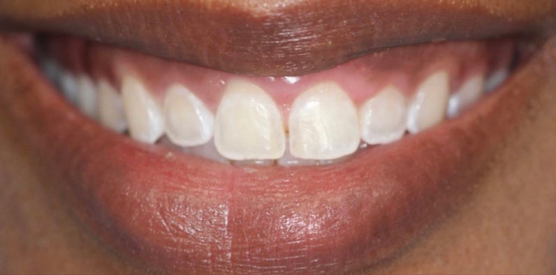 Before Image