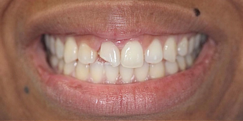 Before Image