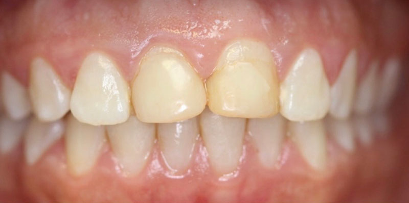 Before Image