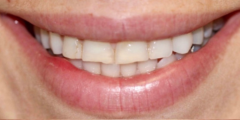 Before Image