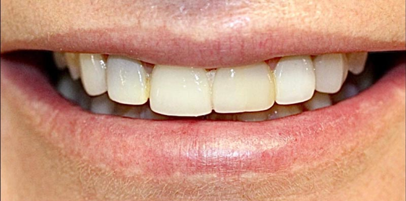 Before Image