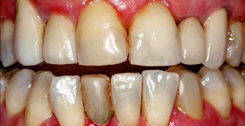 Before Image